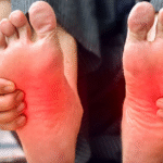 The Impact of Lifestyle Modifications on Neuropathy Symptoms