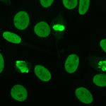 The role of anti-dsDNA antibodies in autoimmune diseases