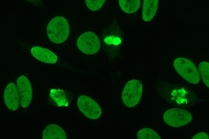 The role of anti-dsDNA antibodies in autoimmune diseases
