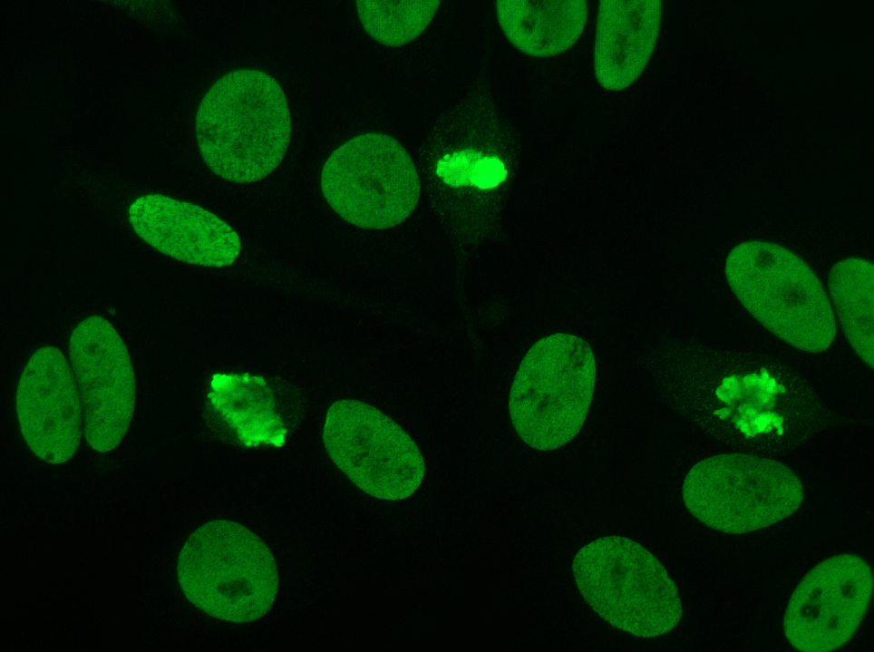 The role of anti-dsDNA antibodies in autoimmune diseases