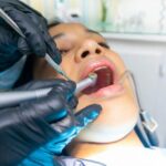 How 3D Printing is Changing the Game in Cosmetic Dental Care