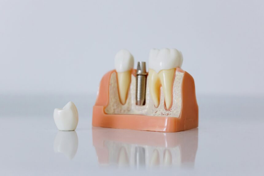 Warning Signs and Aftercare Tips for Dental Implant Success