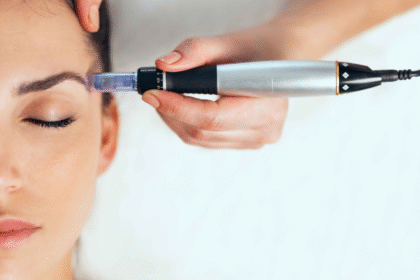 Why Microneedling is Gaining Popularity in Singapore's Aesthetic Clinics