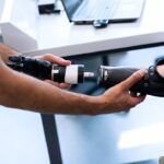 Compensation for Amputation Injuries: Legal Options