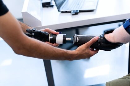 Compensation for Amputation Injuries: Legal Options